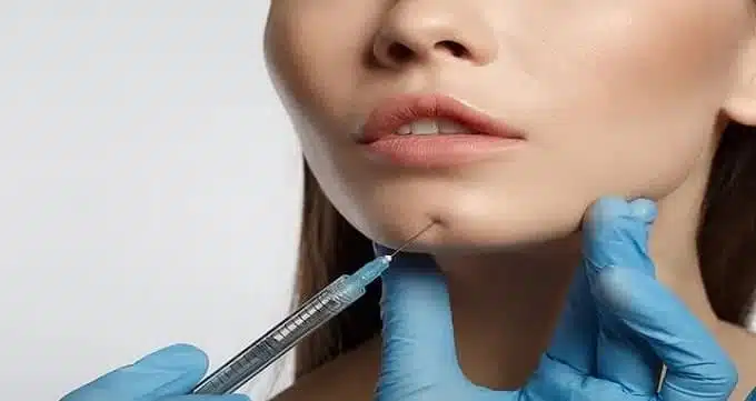 کانتورینگ صورت، ژل لب، فیلر شقیقه، فیلر کات گونه، فیلر چانه در صادقیه تهران