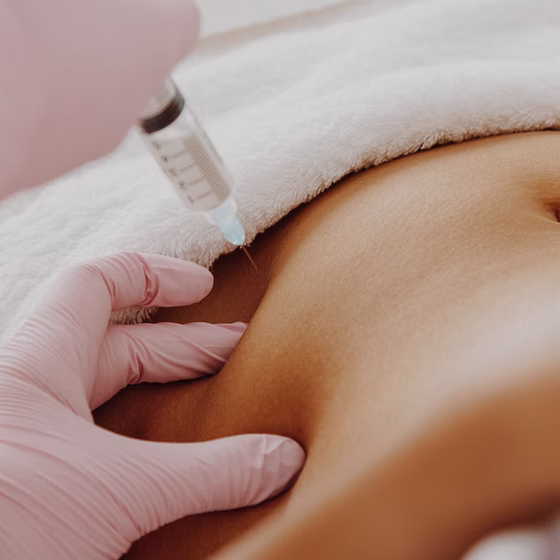 فیلر بادی در صادقیه تهران (Body Filler)