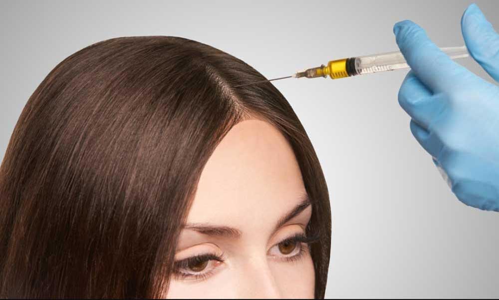 هیر فیلر مو و ابرو در صادقیه تهران (Hair Filler)