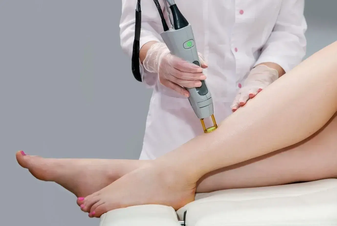 لیزر موهای زائد در صادقیه تهران (Laser Hair Removal)